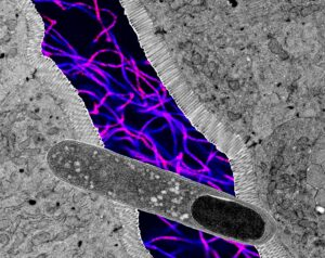 us-researchers-identify-gut-bacteria-that-may-aid-weight-loss-and-improve-metabolic-health