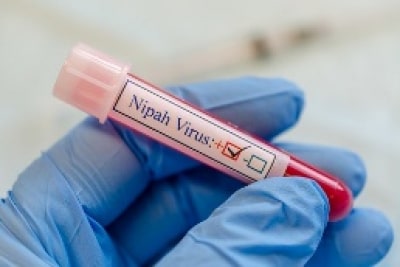 nipah-monoclonal-antibody-to-undergo-human-trials-in-india-bangladesh-in-2025