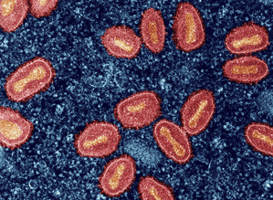India must focus on genomic surveillance of Mpox virus to curb spread: Experts