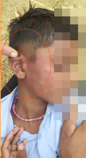 class-3-student-beaten-mercilessly-in-rajasthan-school-teacher-suspended