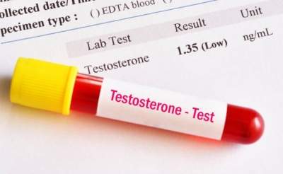 Testosterone-replacement therapy not for athletes, bodybuilders: Study